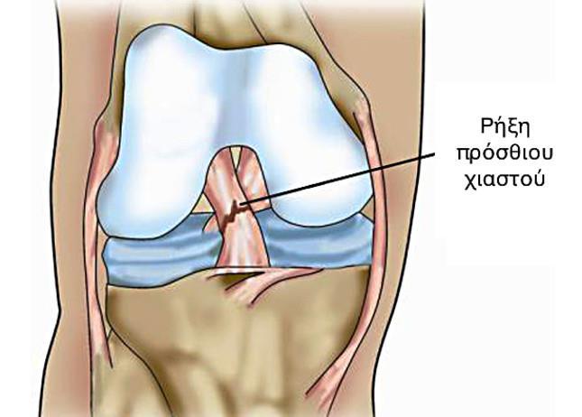 Τέλος, στο τρίτο κεφάλαιο αναφέρονται συγκεκριμένοι τρόποι δράσης του ανθρωπίνου εξειδικευμένου δυναμικού που ανέλαβε την αποκατάσταση και επανένταξη του αθλητή, για μια