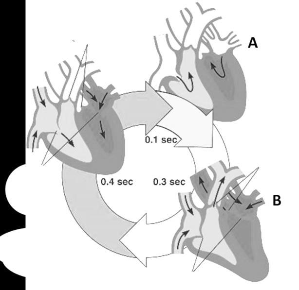 (β) Το πιο κάτω σχεδιάγραμμα παρουσιάζει ένα πλήρη καρδιακό κύκλο στον οποίο διακρίνονται τρία στάδια. Ι. Να ονομάσετε τα στάδια Α, Β και Γ. (3 Χ 0.5=1.5μ) Α Β Γ ΙΙ.