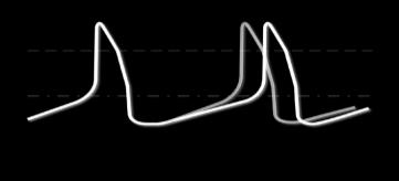 1996;118:1051-1057 2. Bucchi A, et al. J Gen Physiol. 2002;120:1-13, 3.
