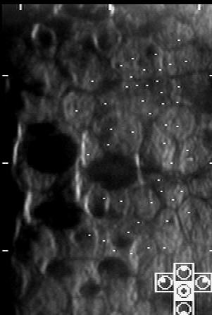 Εικόνα 23. και 24. Ενδοκυτταρικές φωτεινές δομές, που κάποιες μπορεί να είναι πυρήνες, φαίνονται στο ενδοθηλιακό φωτομικρογράφημα.