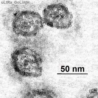 Chronic Hepatitis C Brief History 1970: elevated AST/ALT No disease 1980: NonA-NonB hepatitis Mild disease 1990: HCV infection Major Health Problem 2000: Combination