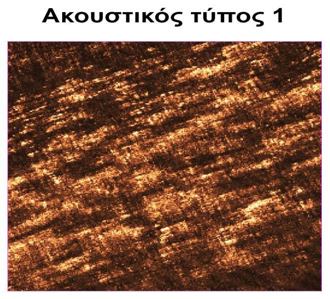 αποτύπωση Ο ακουστικός τύπος 2, ο οποίος φαίνεται στην Εικόνα 4.
