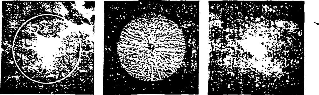 Σχήμα 3.3: Ανίχνευση μάζας χρησιμοποιώντας gradient orientation map.