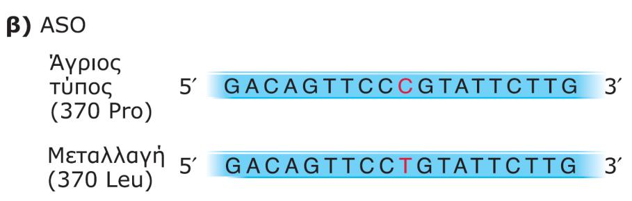 μεταλλάξεων με PCR και υβριδιςμό ASO