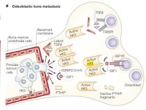 Εικόνα 6: Ρόλος των καλλικρεϊνών στη δημιουργία οστεοβλαστικών μεταστάσεων στον καρκίνο του προστάτη.