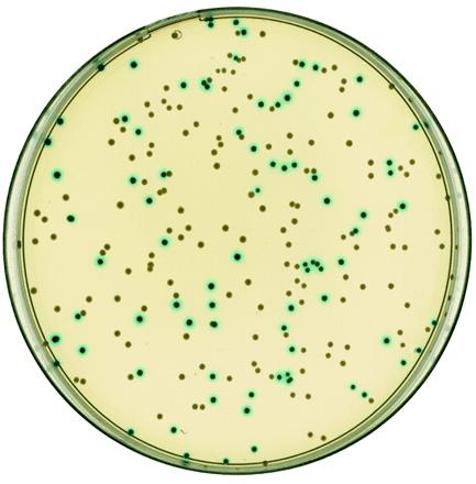 Τα βακτήρια μετά τη λιγάση αναπτύσσονται σε τρυβλία με αμπικιλλίνη και X-Gal