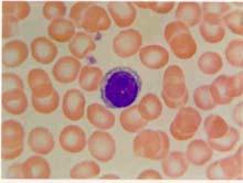 T limfne ćelije