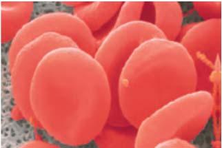 Hem v hemoglobinu veže kisik in ga prenaša po krvi iz pljuč do perifernih tkiv 6-9 m Hb se nahaja v eritrocitih Eritrociti so