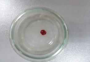 KOAGULACIJA U UŽEM SMISLU FAKTORI KOAGULACIJE ISKRVARENJE TROMBOZA 4. FIBRINOLIZA 3.