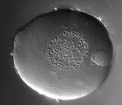 Χαρακτηριστικά ωοκυττάρου