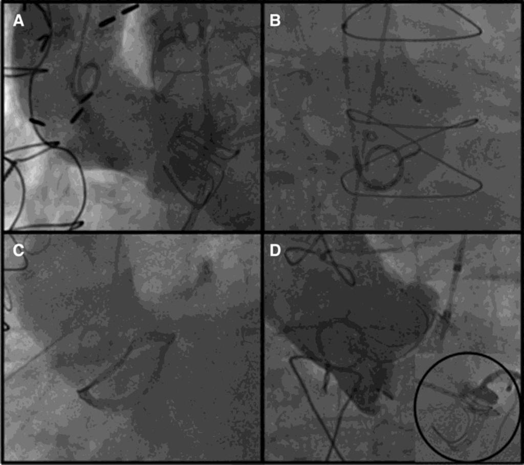 Common technical issues limiting fluoroscopic assessment of the risk