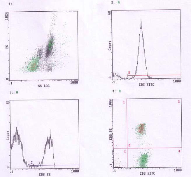 CD3+ CD8+ CD3+/CD8+ Εικόνα 2β: Μέτρηση των CD3+ και CD8+