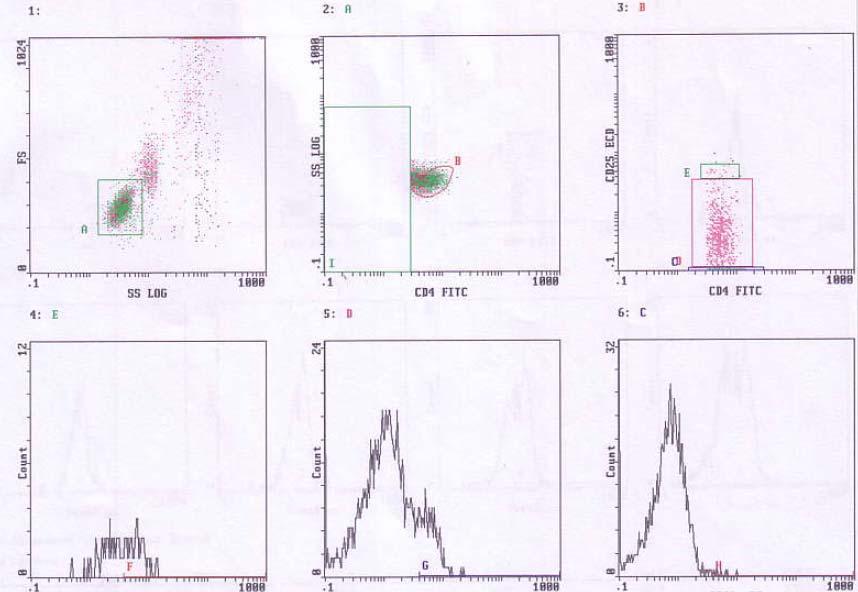 CD4+ CD4+/CD25+ high FoxP3+ FoxP3+ FoxP3+ Εικόνα 2ε: Μέτρηση των Τ ρυθμιστικών λεμφοκυττάρων