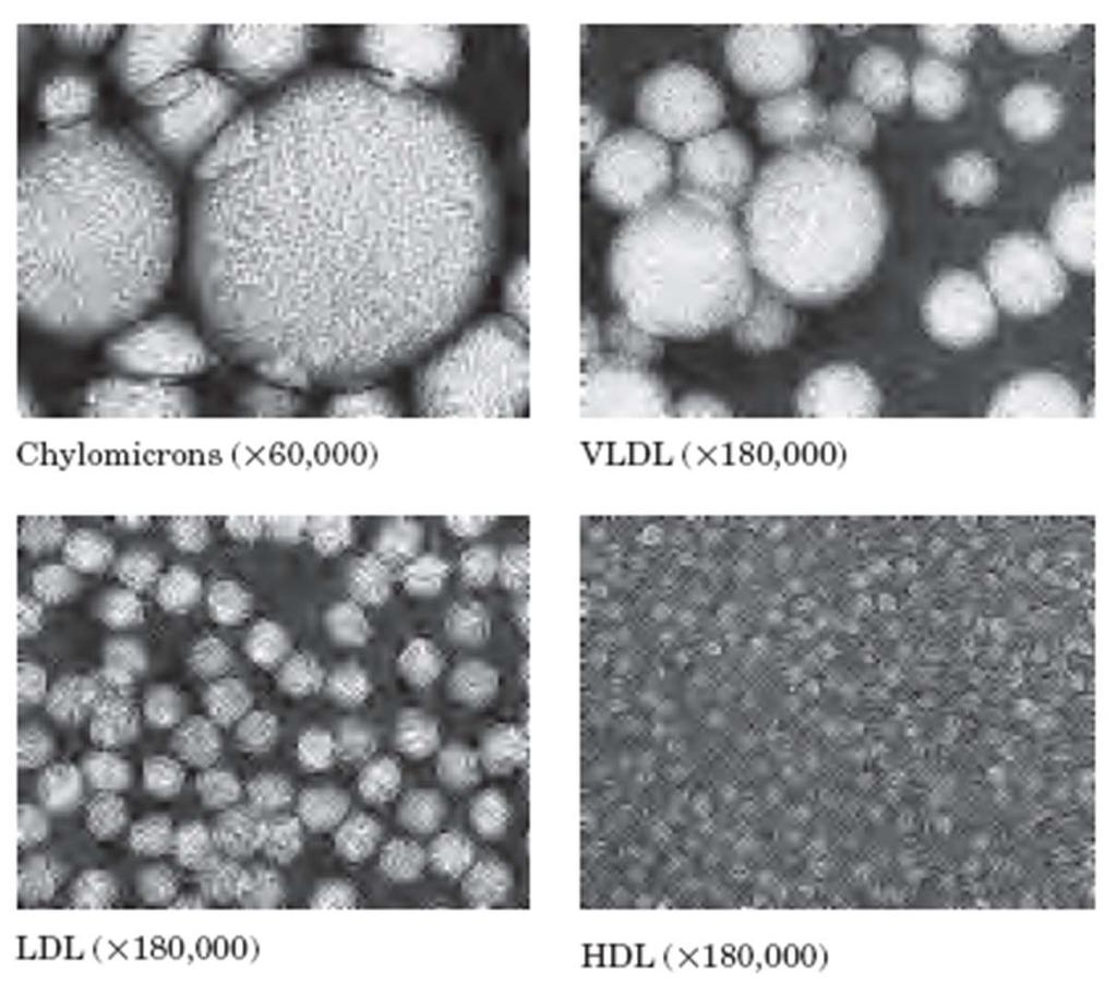 Lipoproteini Struktura LDL z