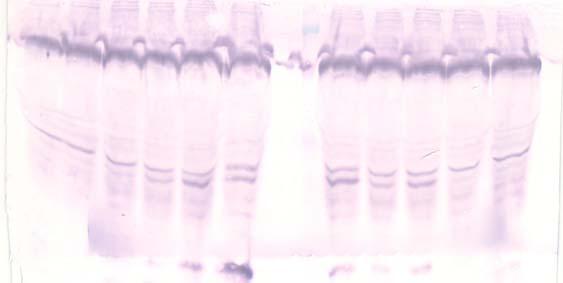 i ) Κινητική δειγμάτων dix+dvii+viia+/-tp (εικόνα 11) Χρησιμοποιήθηκε πλάσμα με έλλειψη του FIX καθώς και πλάσμα με έλλειψη του FVII.