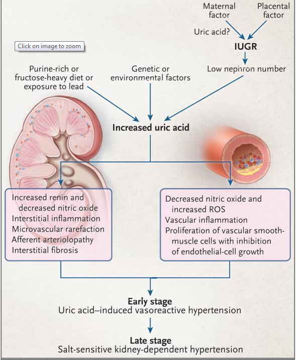 Proposed Mechanism for