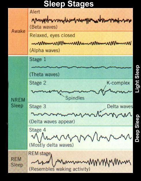 Στάδια του ύπνου Ο ύπνος διακρίνεται σε REM και