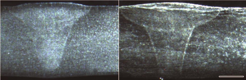 Ö ÓÄ : Î º»À À Æ 5 Efflux plasma voltage, mv 1 Time, s Efflux plasma voltage, mv 1 Efflux plasma voltage, mv 1 1 1 (c) 1 Time, s 1 1 Time, s 7 Ð ÅÛ Å Û µ Fig.