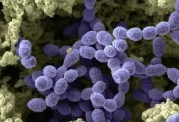 1.3.β Ομπγαιαθηηθά βαθηήξηα γηανύξηεο ηξεπηόθνθθνη Σα ζηεθέπδ ημο βέκμοξ Streptococcus έπμοκ ιμνθή ηυηηςκ ζπδιαηίγμκηαξ αθοζίδεξ ηαζ έπμοκ δζάιεηνμ 0,5-2 ιm.