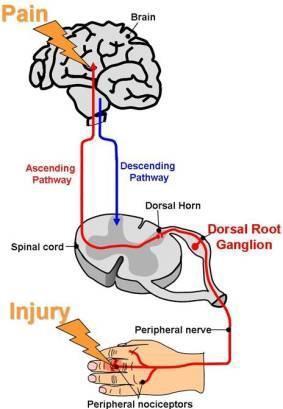 Το «μονοπάτι» του πόνου Τραύμα ή ερέθισμα ενεργοποιεί περιφερικούς υποδοχείς πόνου Σήμα πόνου μεταδίδεται στον εγκέφαλο μέσω ανιούσας οδού Κατιούσα