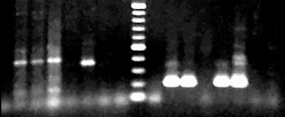 Μοριακές τεχνικές (PCR) (4) Βοθρίωση του