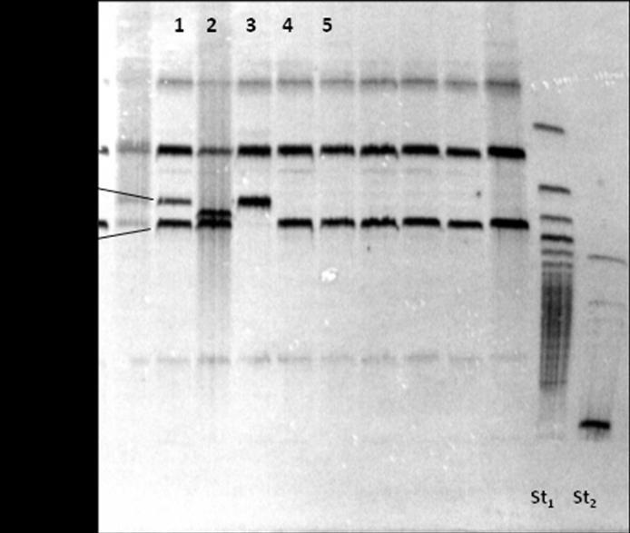 Zadatak 4. Analiza polimorfizama u genu za apolipoprotein E Ljudski gen APOE nalazi se na 19. kromosomu (19q13.