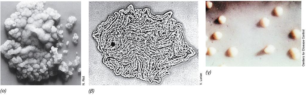 ΑΠΟΙΚΙΕΣ MYCOBACTERIUM TUBERCULOSIS Εικόνα 12.70: Χαρακτηριστική μορφολογία αποικίας μυκοβακτηρίων, (α) Mycobacterium tuberculosis: φαίνεται η συμπαγής, ρυτιδωμένη όψη της αποικίας.