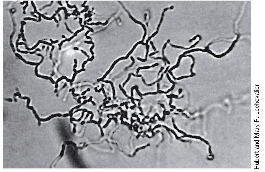ΝΗΜΑΤΟΕΙΔΗ GRAM+ ΒΑΚΤΗΡΙΑ ΥΨΗΛΟΥ GC: ΑΚΤΙΝΟΜΥΚΗΤΕΣ Εικόνα 12.72: Νεαρή αποικία ακτινομύκητα του γένους Nocardia, όπου φαίνεται η τυπική νηματοειδής κυτταρική δομή (μυκήλιο).
