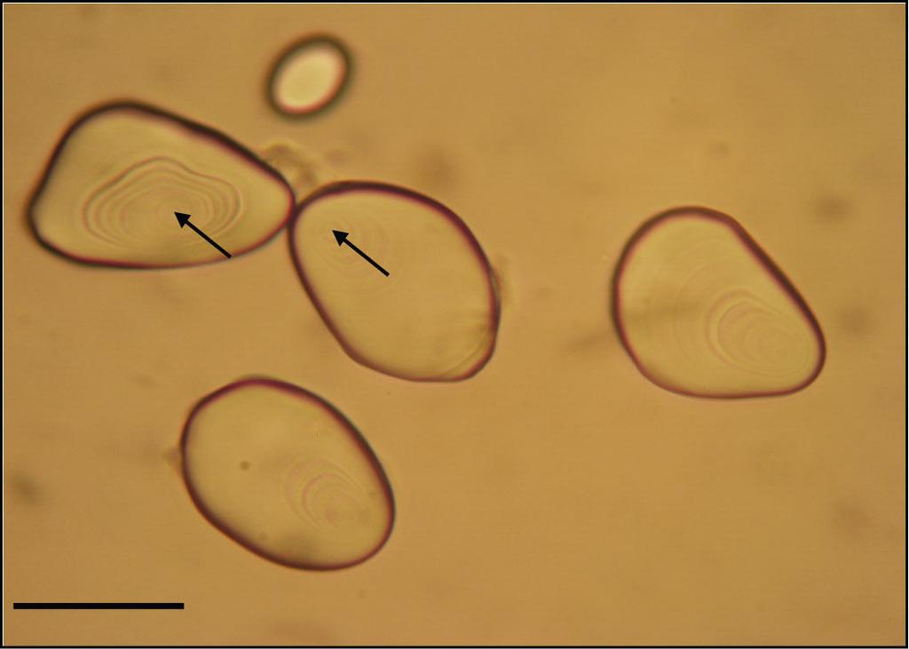 2. ERGASTIČNE TVOREVINE 2.1. Škrobna zrnca Materijal: gomolj krumpira (Solanum tuberosum L.), sjemenke graha (Phaseolus vulgaris L.), sjemenke kukuruza (Zea mays L.), sjemenke zobi (Avena sativa L.