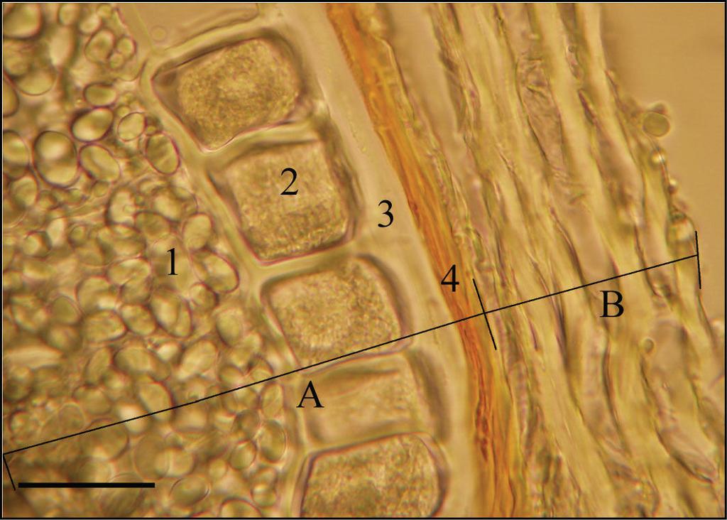 2. ERGASTIČNE TVOREVINE 2.2. Aleuronska zrnca Materijal: pšeno pšenice (Triticum aestivum L.), sjemenke ricinusa (Ricinus communis L.). Pribor: predmetnice, pokrovnice, histološke iglice, kapaljka, pinceta, oštri nožić, svjetlosni mikroskop.