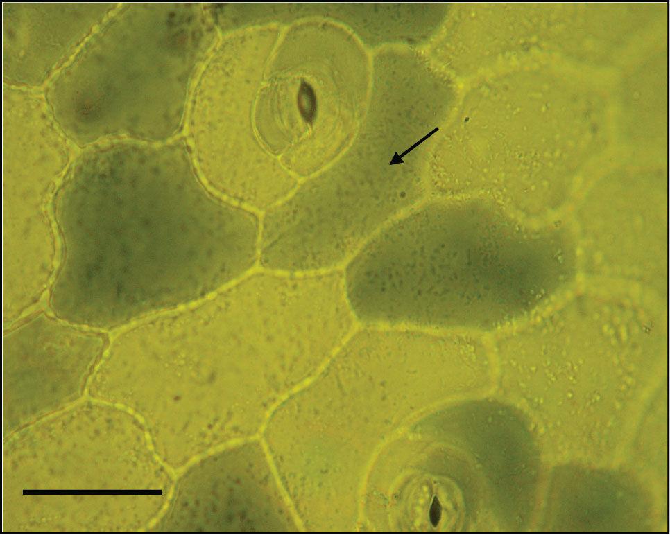 2. ERGASTIČNE TVOREVINE 2.4. Tanini Materijal: list čuvarkuće (Sempervivum tectorum L.). Pribor: predmetnice, pokrovnice, histološke iglice, kapaljka, pinceta, oštri nožić, svjetlosni mikroskop.