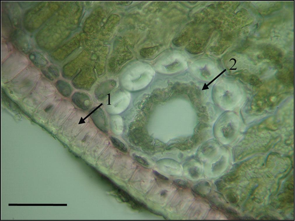 9. ANATOMIJA LISTA Slika 64. Detalj poprečnog prereza iglice crnog bora (Pinus nigra L.). 1 epiderma, 2 smolenica (Skala = 50 µm). Poprečni prerez iglice bora polukružnog je oblika.
