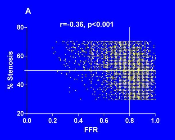 FFR and QCA