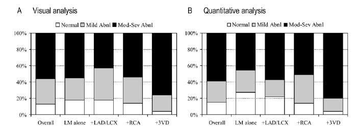 Value of MPI for LMCA stenosis detection 101 patients with