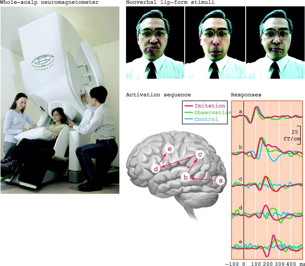 Brain activation during imitation studied with magnetoencephalography Left: magnetoencephalography (MEG) recording with a 306-channel whole scalp neuromagnetometer at