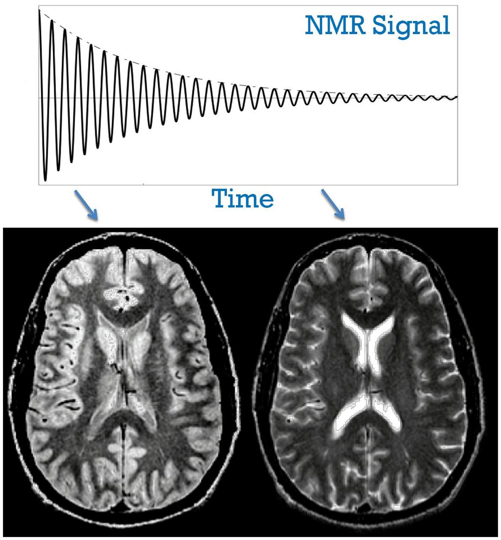 MRI