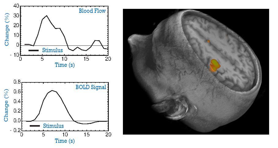 Λειτουργικι μαγνθτικι τομογραφία (fmri)