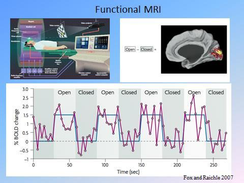 fmri Μάτια