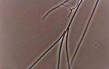 Sphaerotilus natans Microthrix parvicella Type 0092 Haliscomenobacter hydrossis Gram αρνητικό, Neisser αρνητικό,