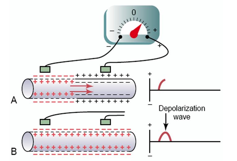 Geneza electrocardiogramei Pentru a înţelege geneza undelor ECG, amplitudinea şi durata acestora este important să fie cunoscute şi înţelese câteva teorii şi principii preluate din fizică şi