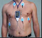 Sensul şi amplitudinea undelor în ECG depind de proiecţia vectorilor rezultaţi pe derivaţiile ECG ale planului frontal şi orizontal.
