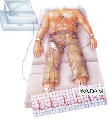 Figura X7. Înregistrarea unei electrocardiograme. Se vizualizează modul de plasare al electrozilor.