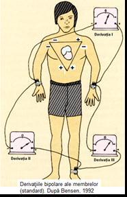 membrele inferioare deasupra gleznei. (fig. X7). În caz de amputaţii electrozii se plasează cât mai aproape de torace, la originea membrului respectiv.