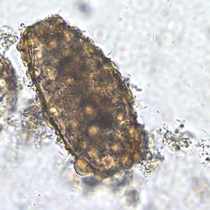 Έξοδος προνύμφης Ascaris lubricoides από το ωάριο (Πηγή: Division of Parasitic Diseases, CDC) Τα μη γονιμοποιημένα ωάρια είναι: α)