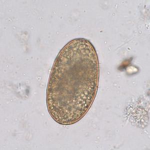 14 Τα αποφλοιωμένα ωάρια είναι ωάρια γονιμοποιημένα ή μη γονιμοποιημένα τα οποία έχουν χασει το εξωτερικο βοθριωτό τους περίβλημα. Εικόνα 6.