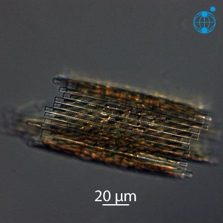 ΦΥΤΟΠΛΑΓΚΤΟ BACILLARIOPHYCEAE Bacillaria paxillifer 1.COSCINODISCUS 2.SKELETONEMA 3.CHAETOCEROS 4.BIDDUALFIA 5.