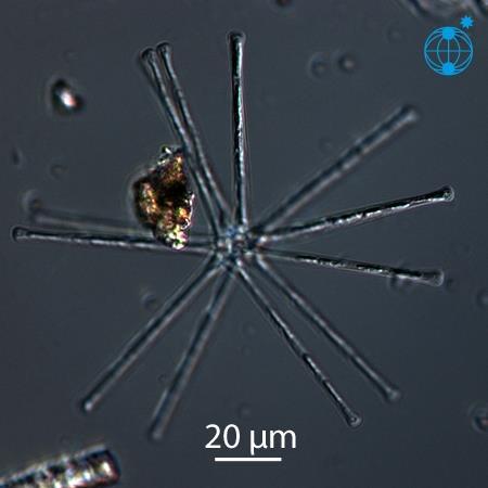 ΦΥΤΟΠΛΑΓΚΤΟ BACILLARIOPHYCEAE Asterionella formosa 1.COSCINODISCUS 2.SKELETONEMA 3.CHAETOCEROS 4.BIDDUALFIA 5.