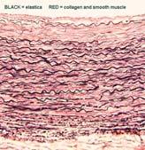 MEMBRANE