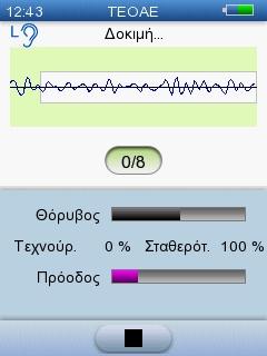 5 Δοκιμή με το AccuScreen 5.2.2 Η δοκιμή TEOAE Η δοκιμή εμφανίζεται στην οθόνη καθώς εξελίσσεται. Εάν είναι απαραίτητο, πατήστε το κουμπί Διακοπή για να σταματήσετε τη δοκιμή.