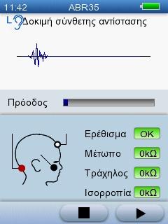 5 Δοκιμή με το AccuScreen Δοκιμή ενός αφτιού Για να ξεκινήσετε τη δοκιμή, πατήστε το κουμπί Έναρξη που βρίσκεται δίπλα στη δοκιμή ABR και αντιστοιχεί στο αφτί στο οποίο τοποθετήσατε το ακροφύσιο